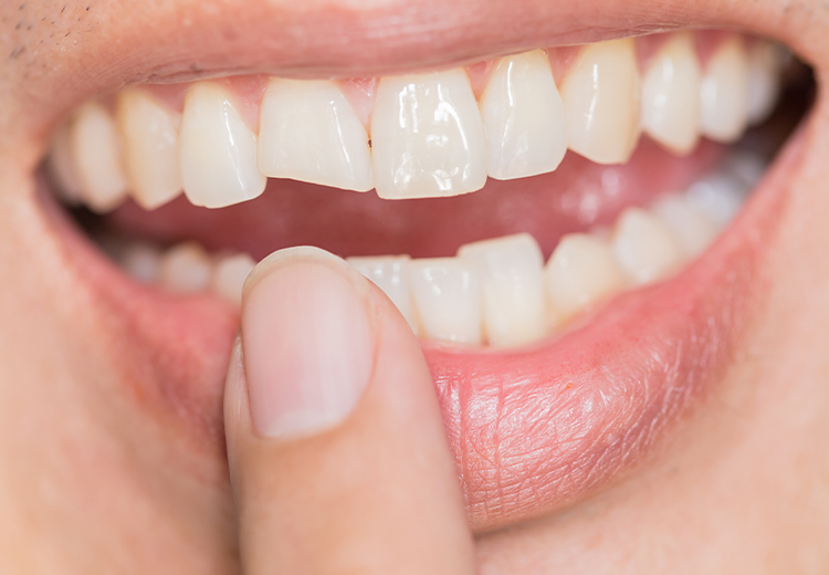rehabilitación oral